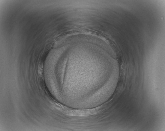 X0000078870033200612111725