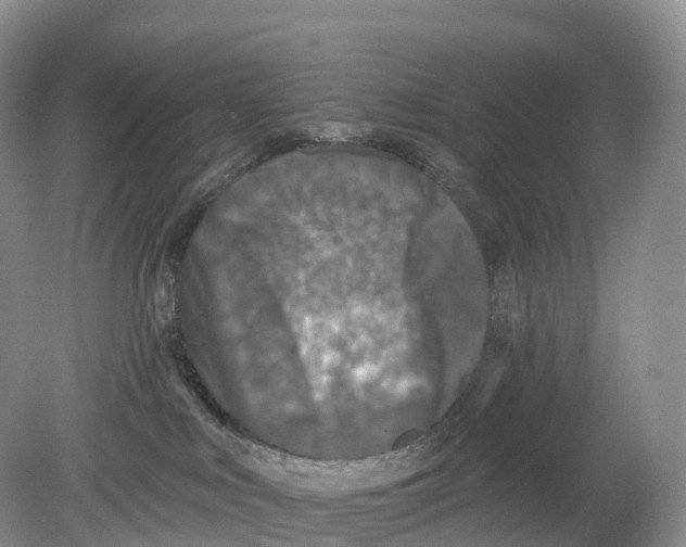 X0000078870043200612111725