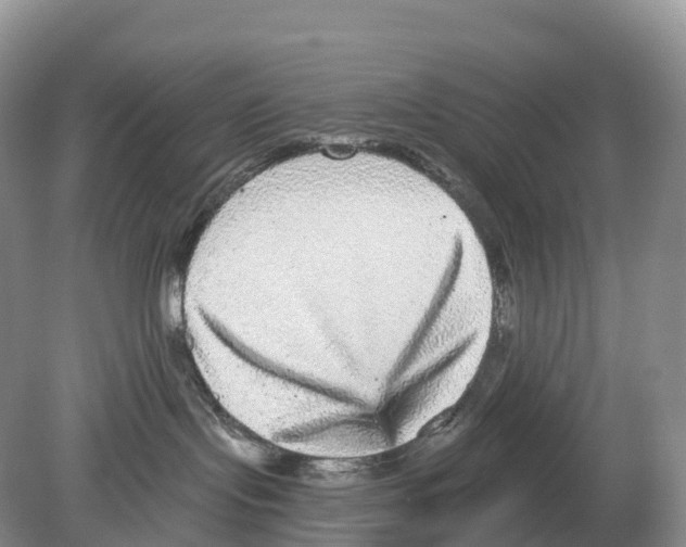 X0000078870095200612111725