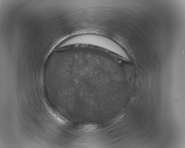 X0000078870156200612111722