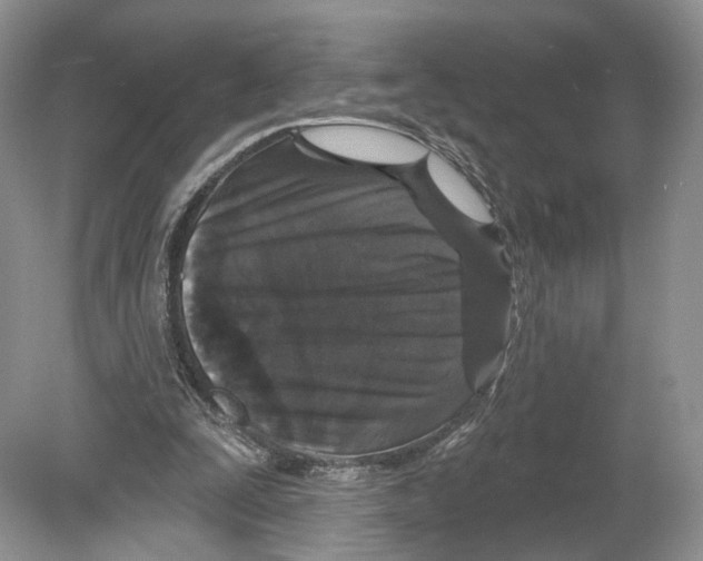 X0000078870295200612111721