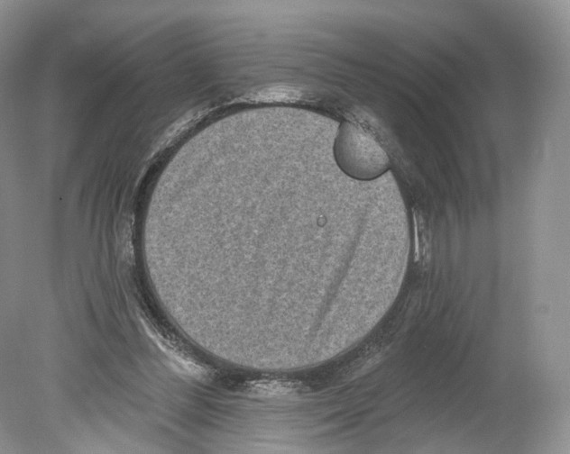 X0000078870300200612111720