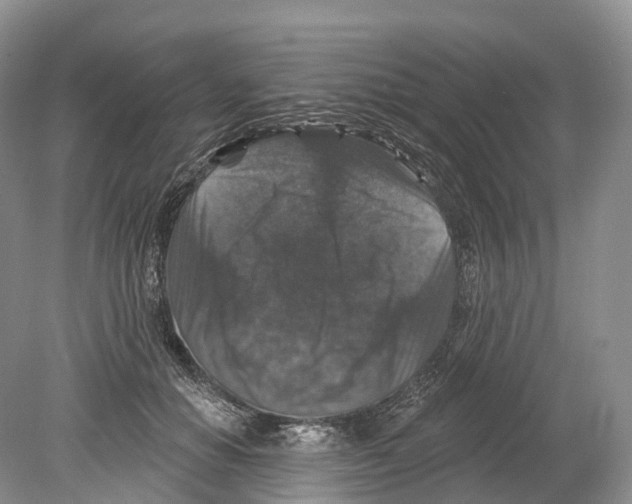 X0000078870654200612111715