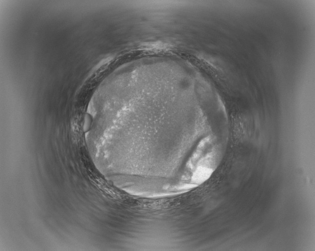 X0000078871254200612111704