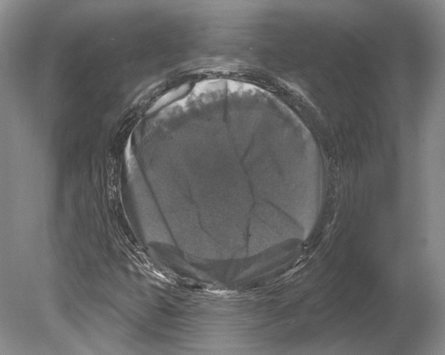 X0000078871399200612111701