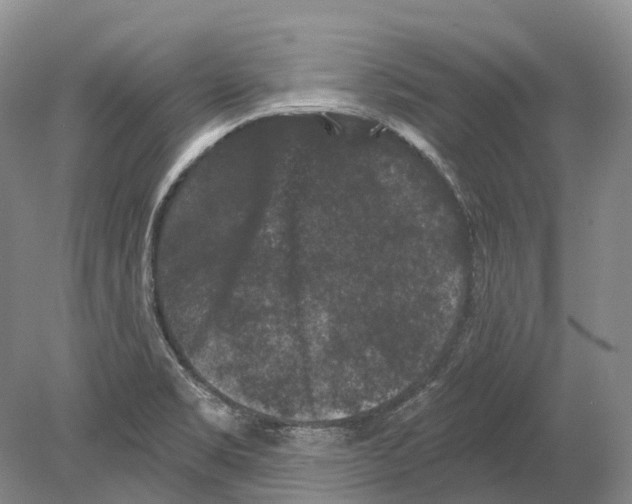 X0000078871469200612111701