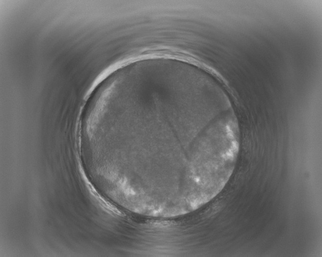 X0000078871522200612111700