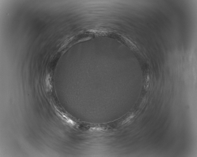 X0000078881010200611201405