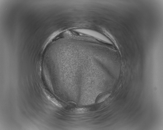 X0000078880059200611271337