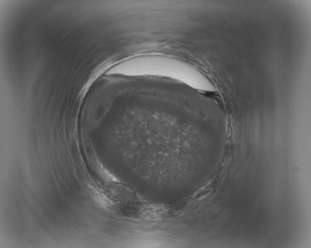 X0000078880099200611271337