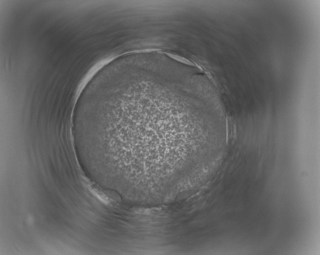 X0000078880147200612042033