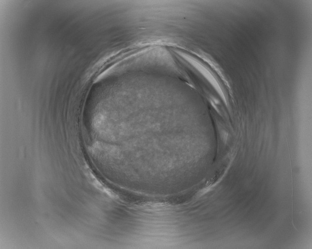 X0000078880577200612042026