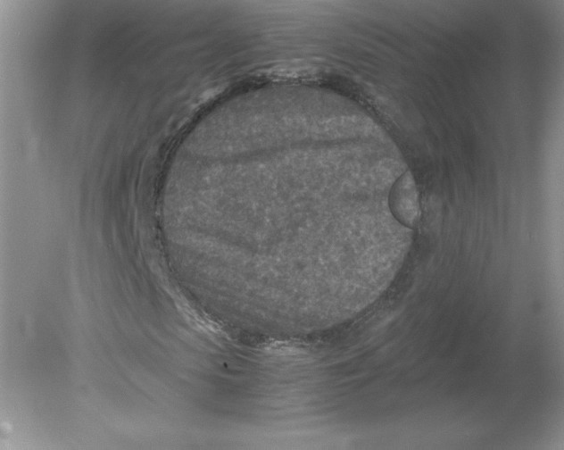 X0000078880913200612042020