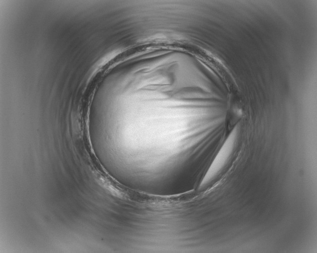 X0000078881018200612042018