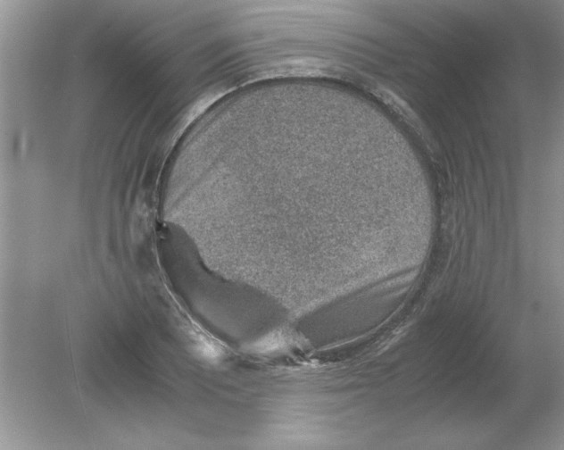 X0000078881081200612042018