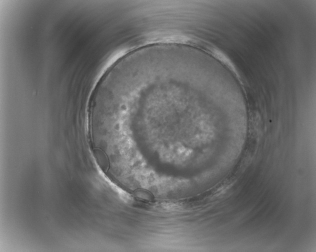 X0000078881095200612042018