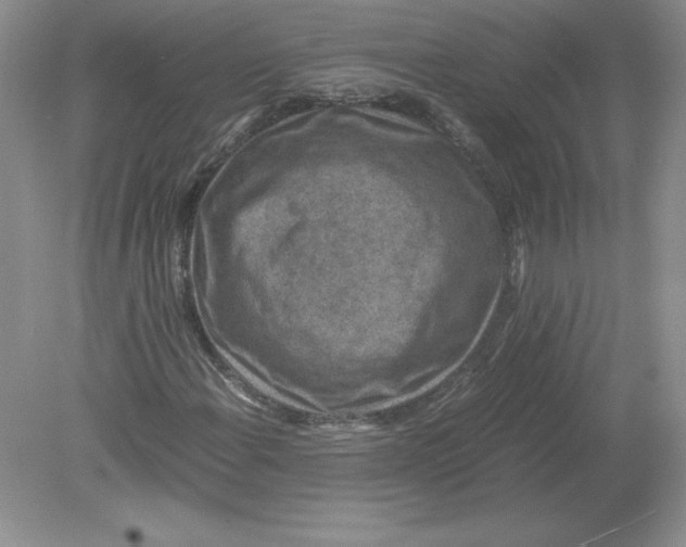 X0000078881108200612042017