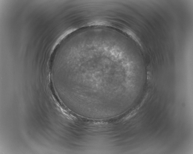 X0000078881117200612042017