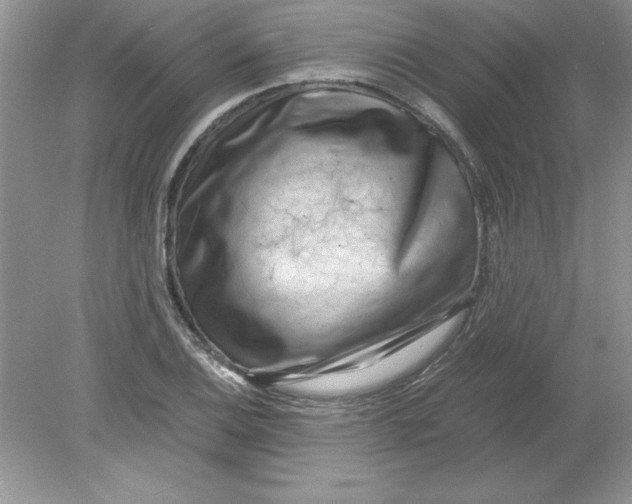 X0000078881124200612042017