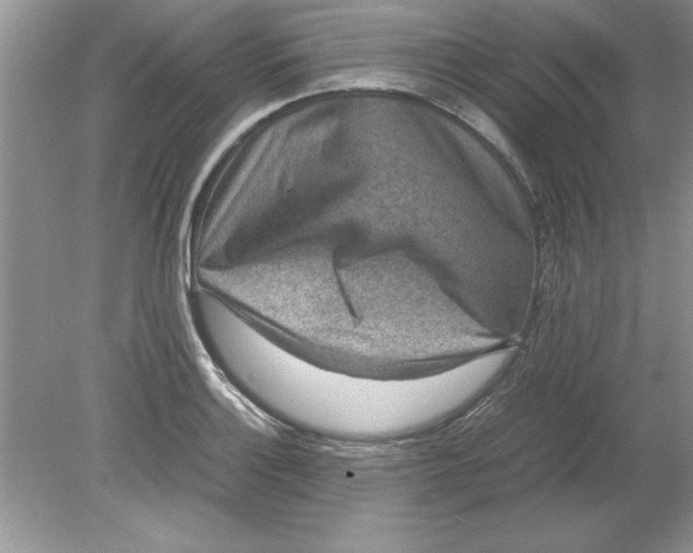 X0000078881132200612042017