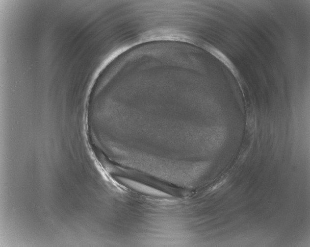 X0000078881144200612042017