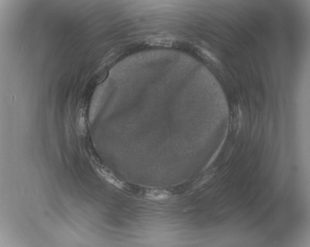 X0000078881154200612042017