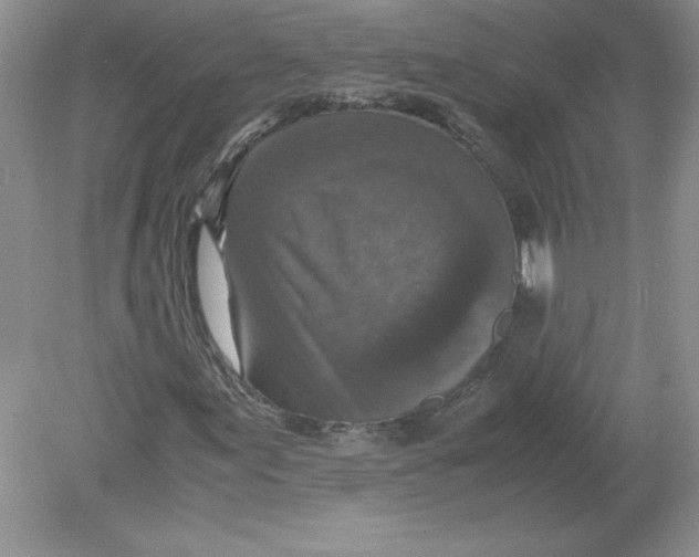 X0000078881155200612042017