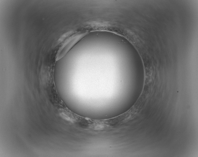 X0000078881157200612042017