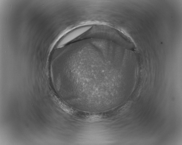 X0000078881173200612042016