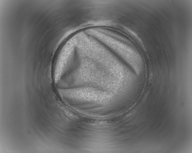 X0000078881174200612042016