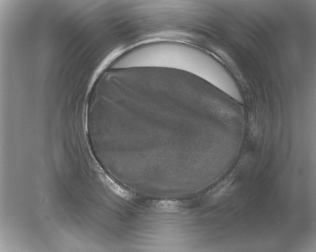 X0000078881180200612042016