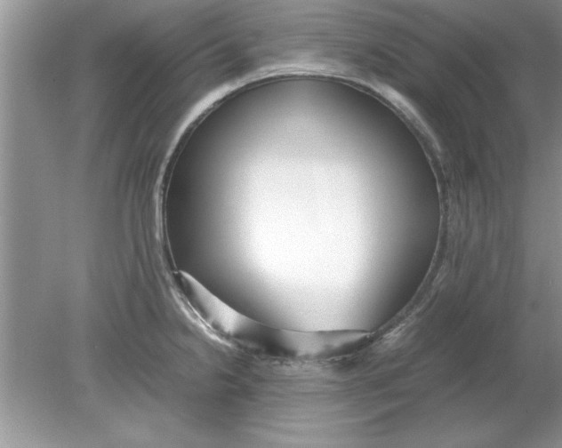 X0000078881238200612042016