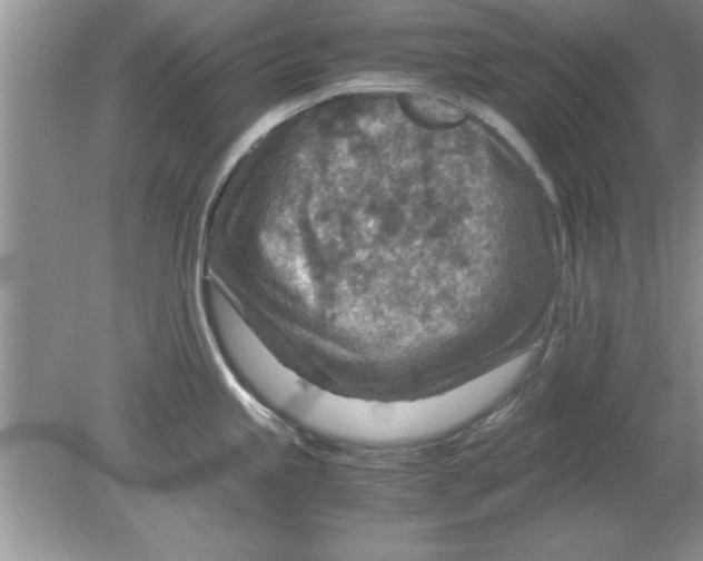 X0000078881245200612042016