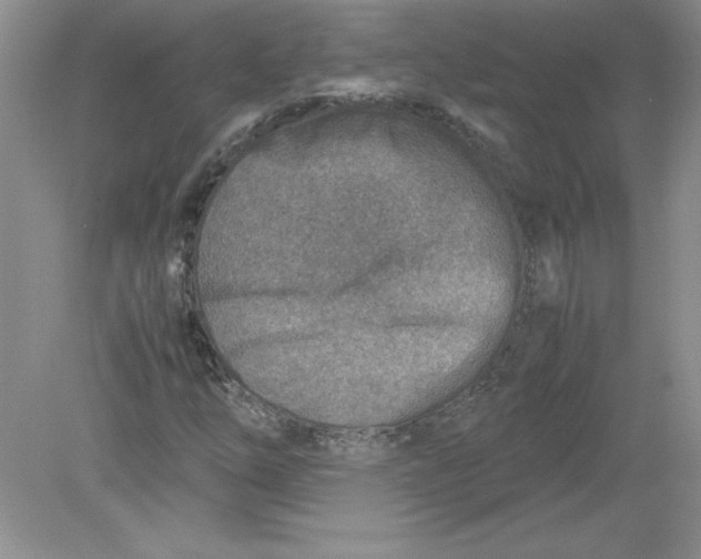 X0000078881254200612042015