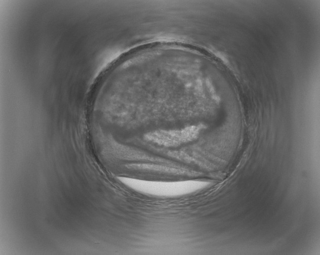 X0000078881263200612042015