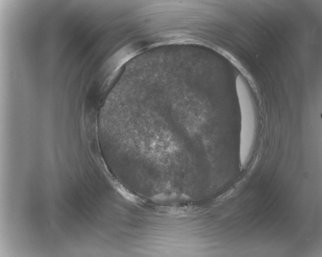 X0000078881289200612042014