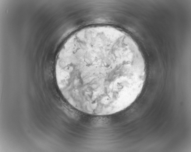 X0000078881314200612042014