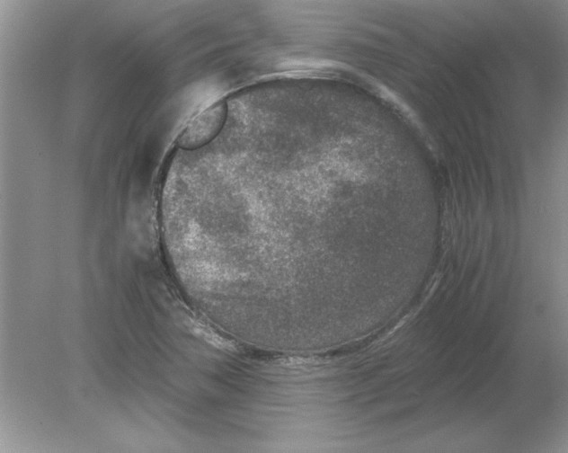 X0000078881362200612042013