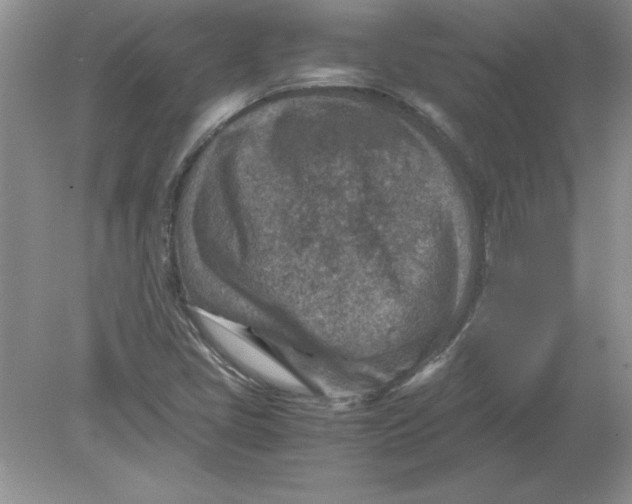 X0000078881405200612042012