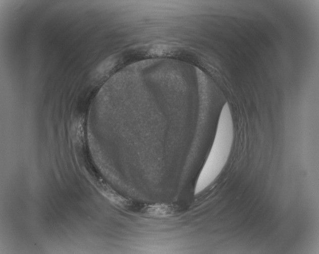 X0000078880127200612111749