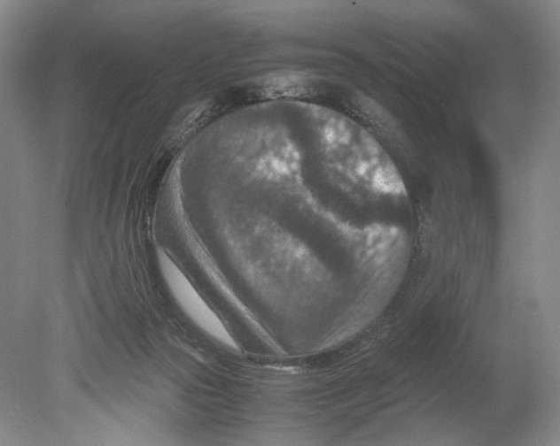 X0000078880169200612111748