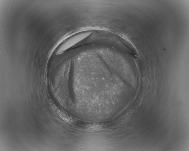 X0000078881173200612111732