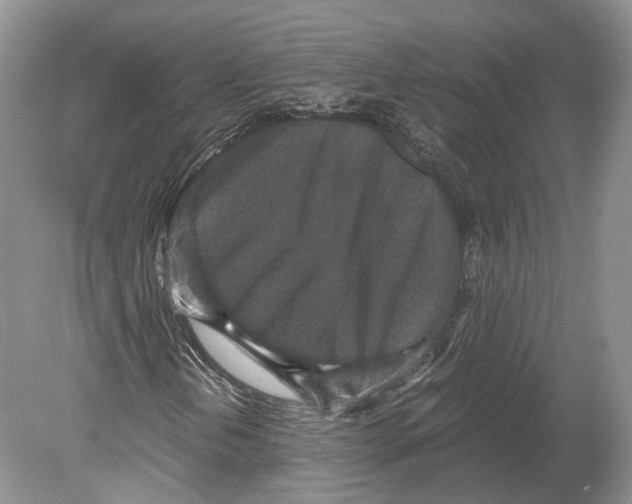 X0000078881202200612111730