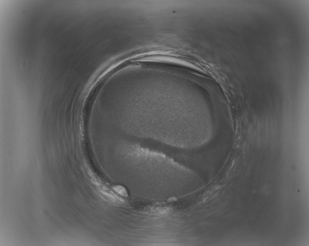 X0000078890247200611201444