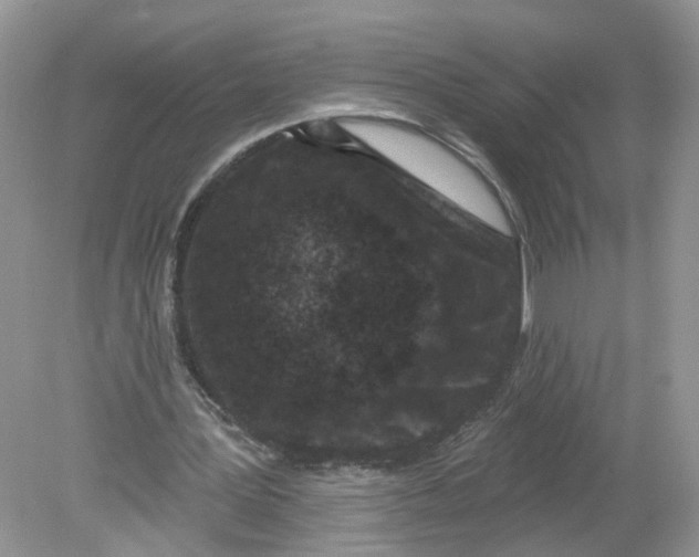 X0000078890387200612042056