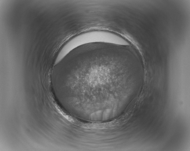 X0000078890009200612111817