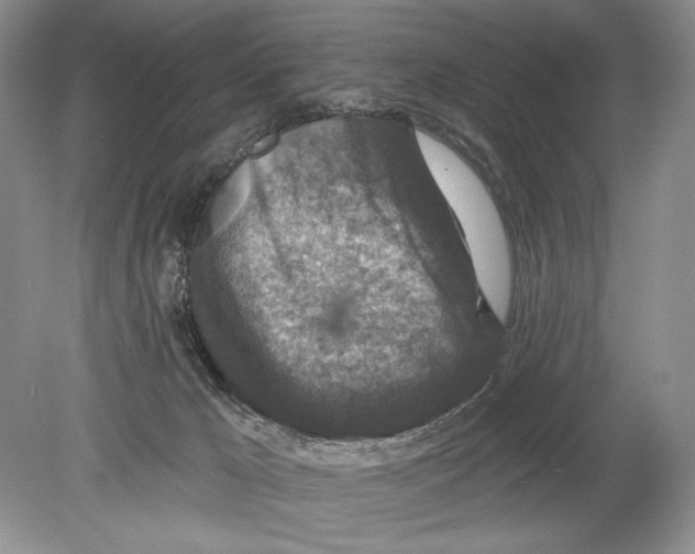 X0000078890029200612111817