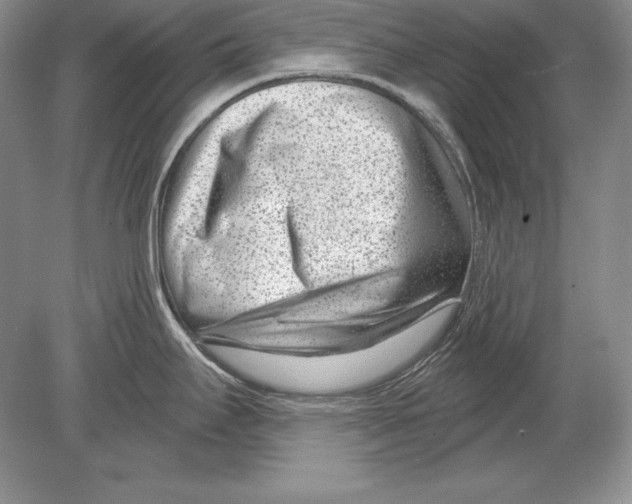 X0000078891295200612111755