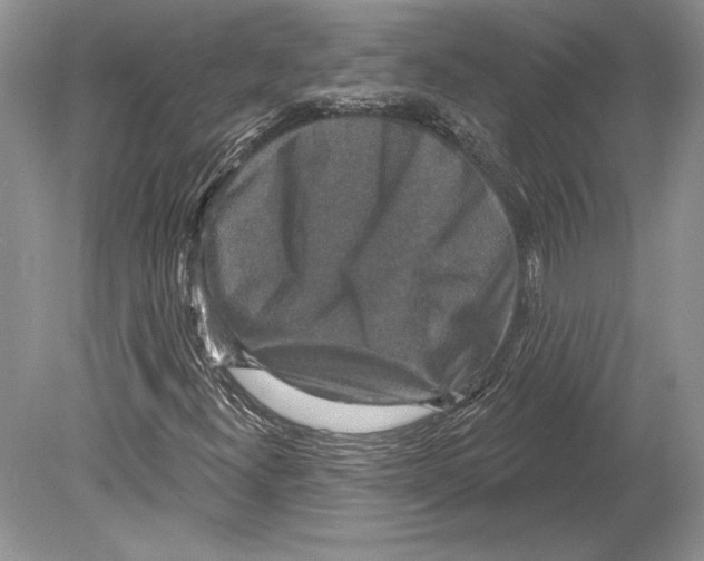 X0000078891300200612111755