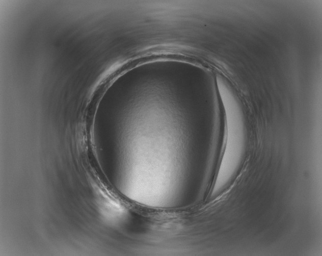 X0000079281164200611171018